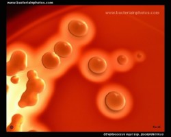 streptococcus zooepidemicus